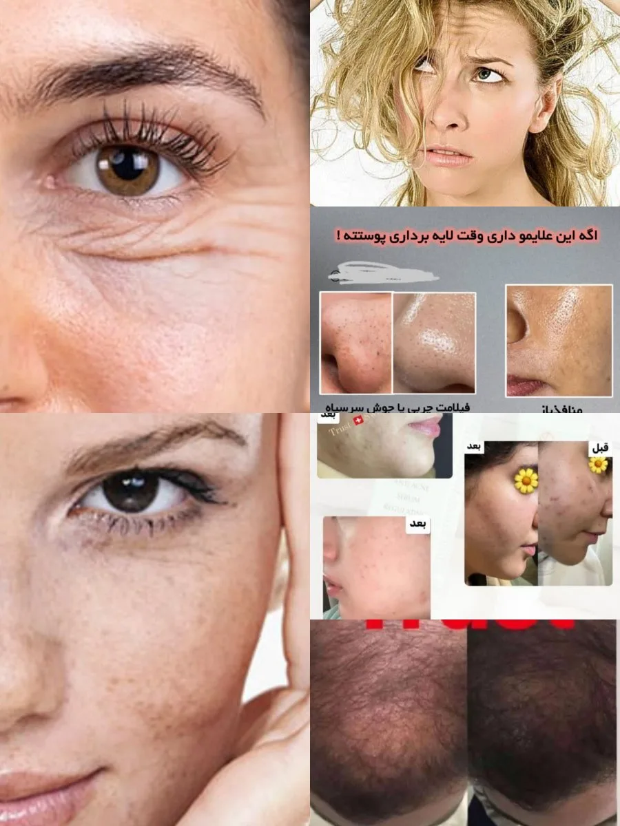 مشاوره رایگان روتین پوستی