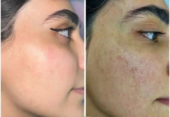 کرم جوانسازی بیوممتیک
